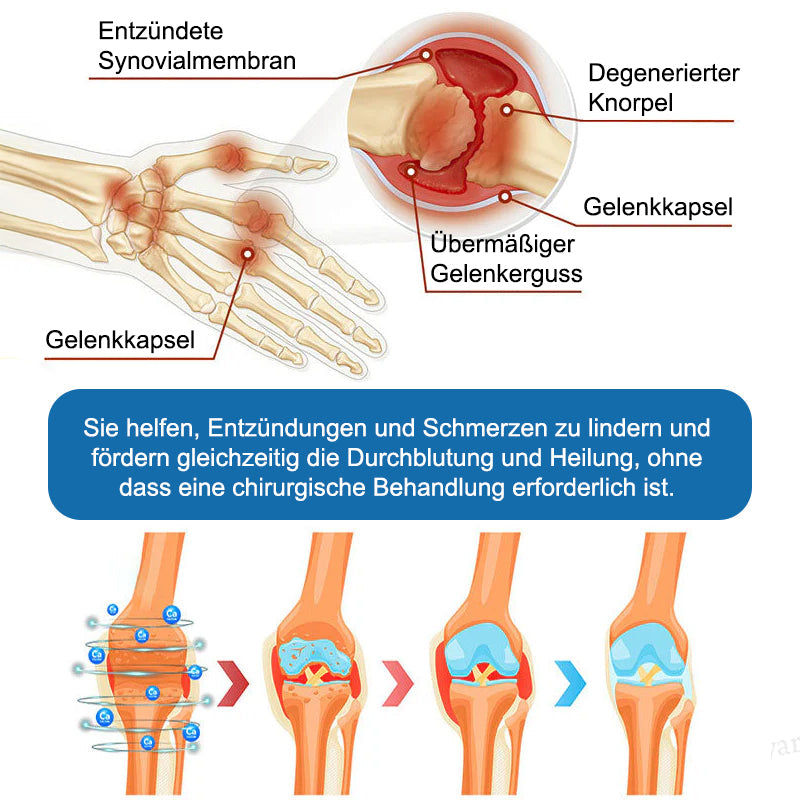 JEREMYTIS™ 𝐁𝐏𝐂-𝟏𝟓𝟕 𝐆𝐞𝐥𝐞𝐧𝐤𝐡𝐞𝐢𝐥𝐬𝐚𝐥𝐛𝐞 🦴 Behandelt Arthritis, Neuropathie, Rheuma, Sportverletzungen und mehr