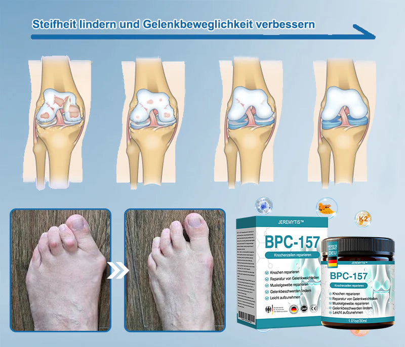 JEREMYTIS™ 𝐁𝐏𝐂-𝟏𝟓𝟕 𝐆𝐞𝐥𝐞𝐧𝐤𝐡𝐞𝐢𝐥𝐬𝐚𝐥𝐛𝐞 🦴 Behandelt Arthritis, Neuropathie, Rheuma, Sportverletzungen und mehr