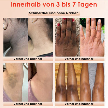 ✨[Offizieller Store] JEREMYTIS™ Peeling-Gel