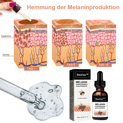 ✨Schneller Dunkelfleckentferner - Seurico™ Melanin Korrigierendes Gesichtsserum