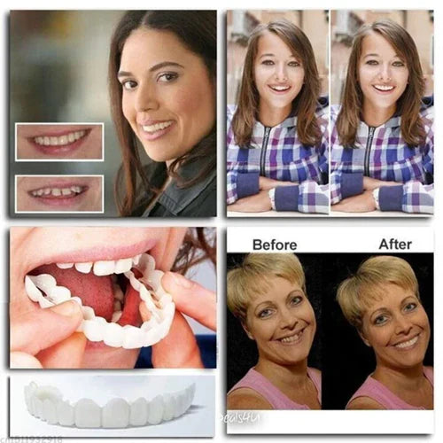 Seurico™ Adjustable Snap-On Dentures