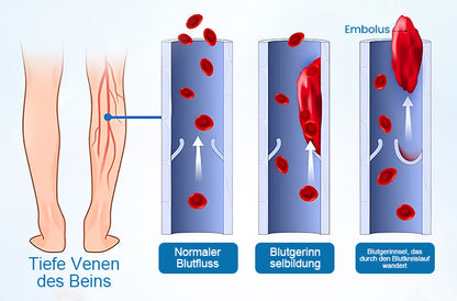 JEREMYTIS® VeinGuard Kräuterspray - ✅ Beseitigen Sie Krampfadern in nur 7 Tagen!