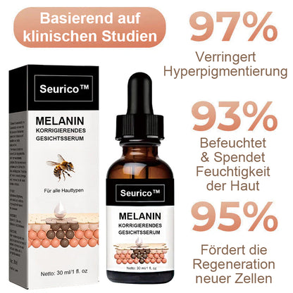 ✨Schneller Dunkelfleckentferner - Seurico™ Melanin Korrigierendes Gesichtsserum