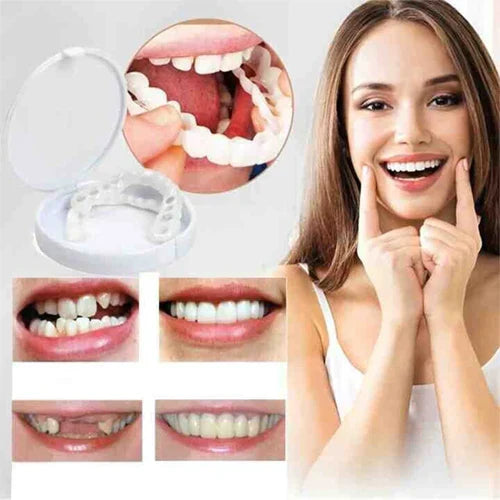 Seurico™ Adjustable Snap-On Dentures