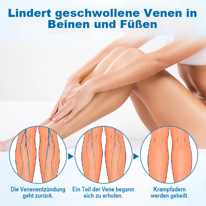 JEREMYTIS® VeinGuard Kräuterspray - ✅ Beseitigen Sie Krampfadern in nur 7 Tagen!