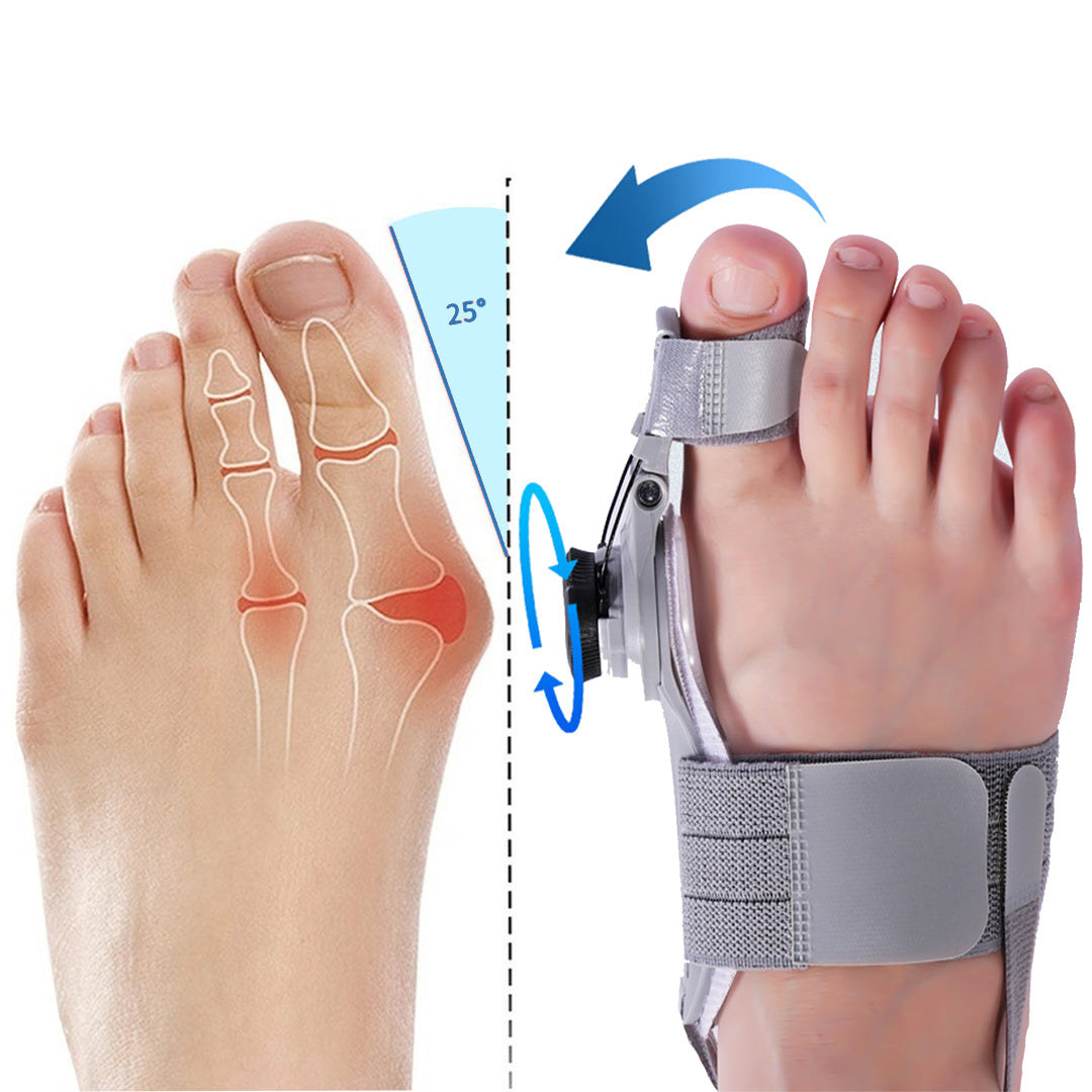 [Offizieller Shop] JEREMYTIS™ Bunion Fix - Natürliche Bunion-Linderung zu Hause